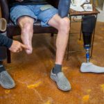 Introduction to Lower Limb Prosthetic