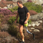 above the knee prosthesis
