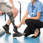 below knee prosthesis