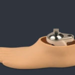 foot prosthesis